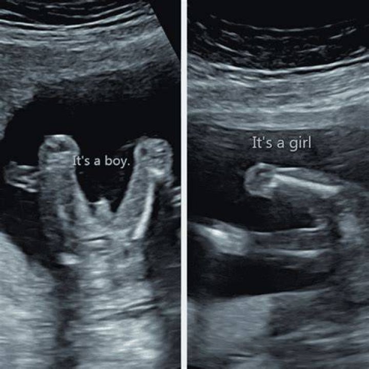Can you find out the gender at 12 weeks?