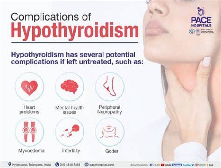 How common is death from hypothyroidism?