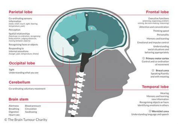 How do brain tumors affect your eyes?