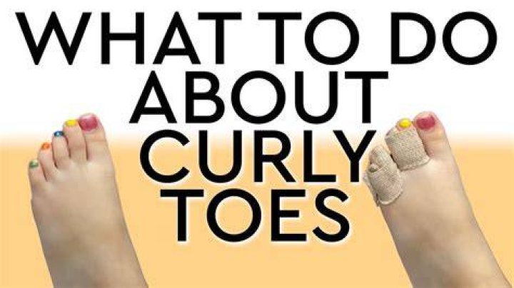 How do you fix a curly pinky toe?