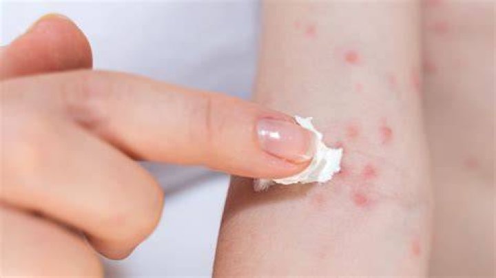 What are fairies allergic to?